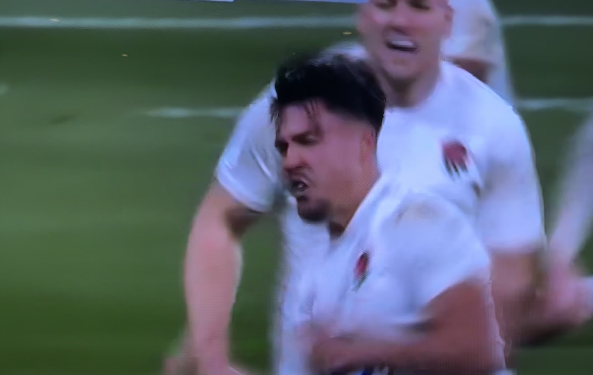 England stuns Ireland